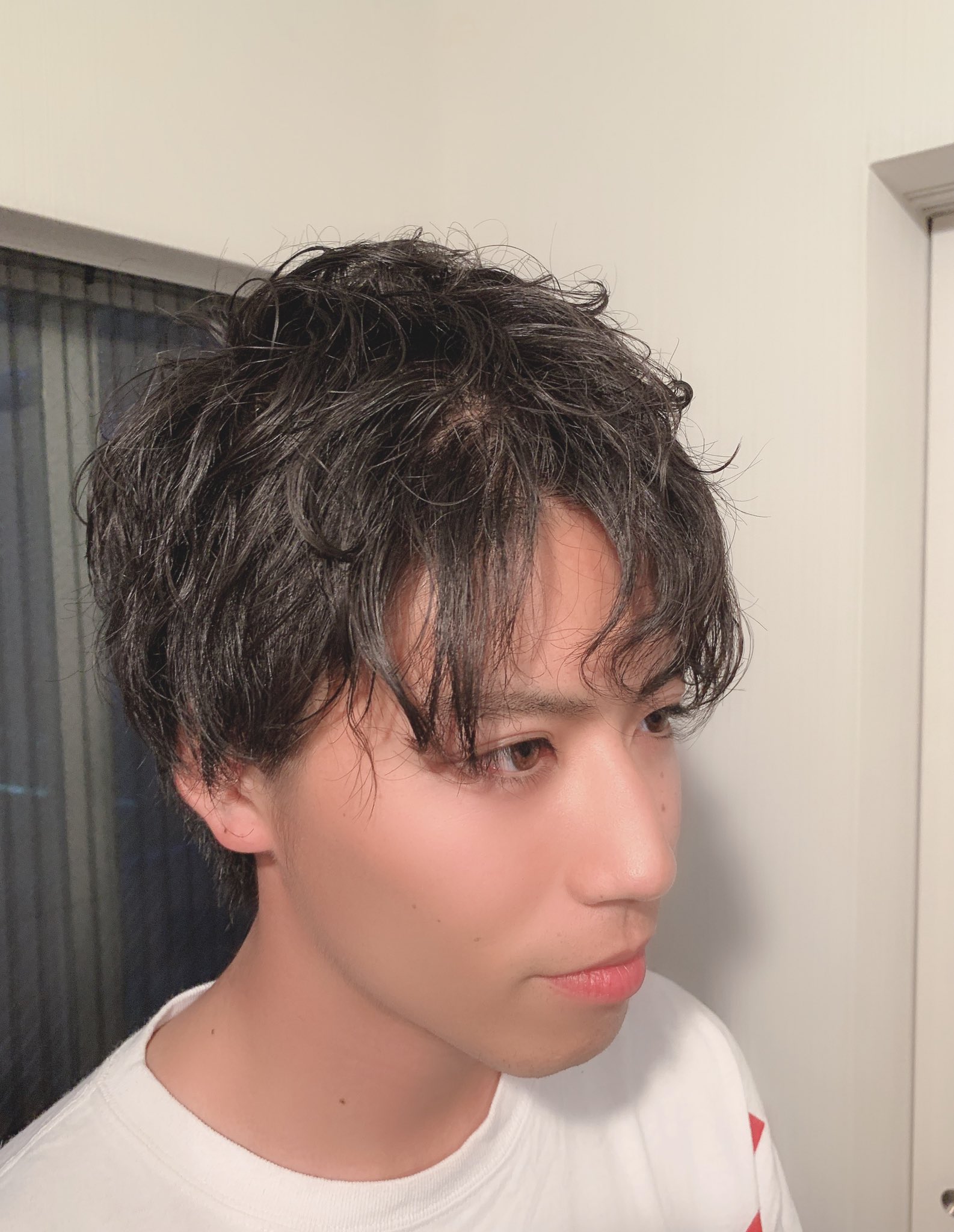 森山 Evisjap 在 Twitter 上 髪切った 大学生のとき頭を8針縫った影響で前頭部が禿げているよ T Co Wemlfquwgx Twitter