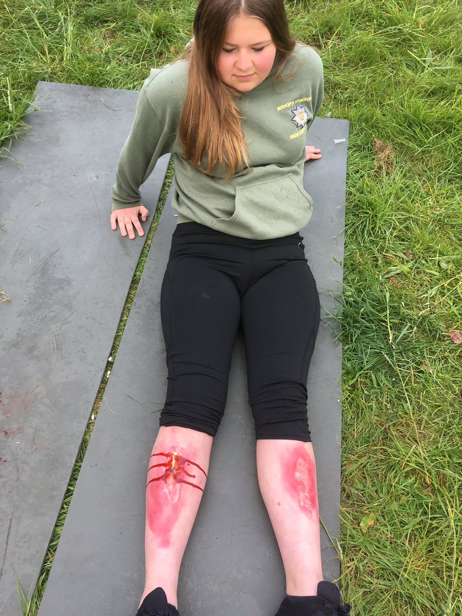 Brother and sister cadets from Bishop’s Stortford were casualties at 7 Brigade (East) First Aid Competition yesterday. Without the casualties the competition cannot take place. Thank you to both of you.