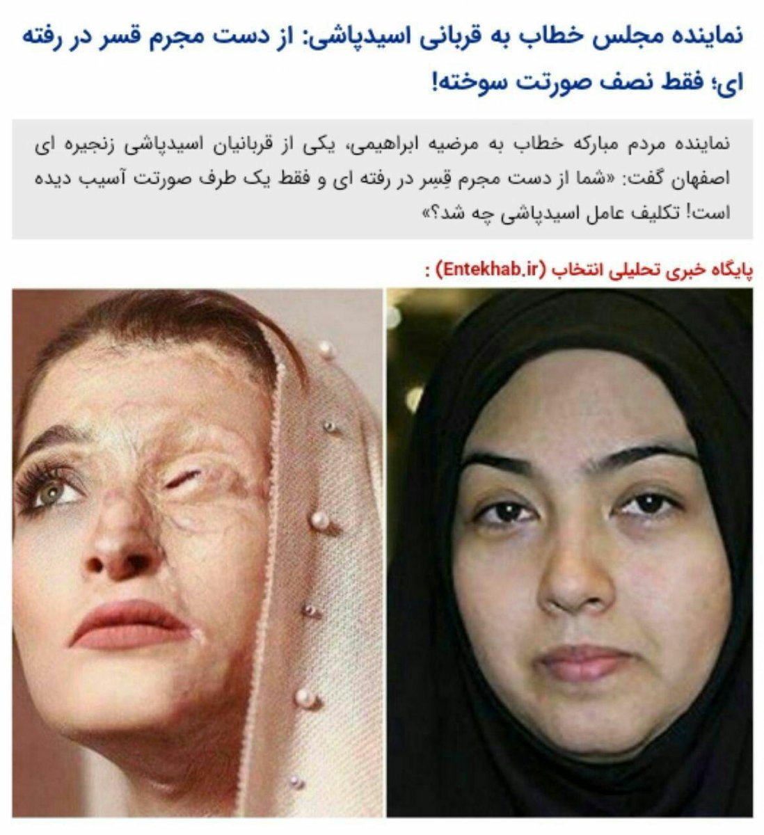 salehpour3's tweet photo. نماینده مجلس خطاب به قربانی اسیدپاشی ازدست مجرم قسر دررفته ای فقط نصف صورتت سوخته
مرضیه ابراهیمی خطاب به زهر�� سعیدی نماینده مبارکه:واقعامتاسفم که شمانماینده اصفهان هستیدونمی دانیدعاملان حادثه اسیدپاشی اصفهان هنوزمشخص نشده اند وبه من می‌گوییدقِسِر در رفته‌ای!
#خامنه‌ای_عامل_ویرانی https://t.co/0AAwcYoJq6