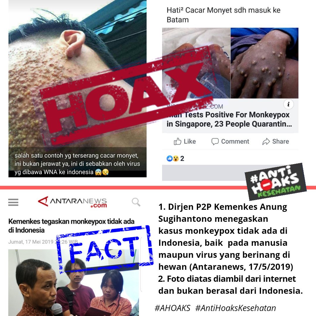 anjarisme's tweet photo. Hoaks: Cacar monyet sudah masuk batam.

Fakta: Dirjen P2P @KemenkesRI Anung Sugihantono menegaskan kasus #monkeypox tidak ada di Indonesia, baik  pada manusia maupun virus yang berinang di hewan.

https://t.co/PUtBxblneU https://t.co/mM8Yu6zIcF