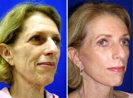NonSurgicalFace's tweet photo. Ode To Yoga Facial Toning Regimens: Essentials Of A Facelift Without Surgery https://t.co/tJzGCOi9pS https://t.co/ehj2DJT3qn
