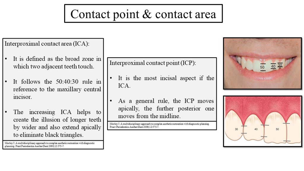 AbdullahAlshoai's tweet photo. #Restorative
#Esthetic
#Smile_Analysis
1- Axial inclination.
2- Contact area & contact point.
3- Incisal embrasure https://t.co/8BqhEsCzjy