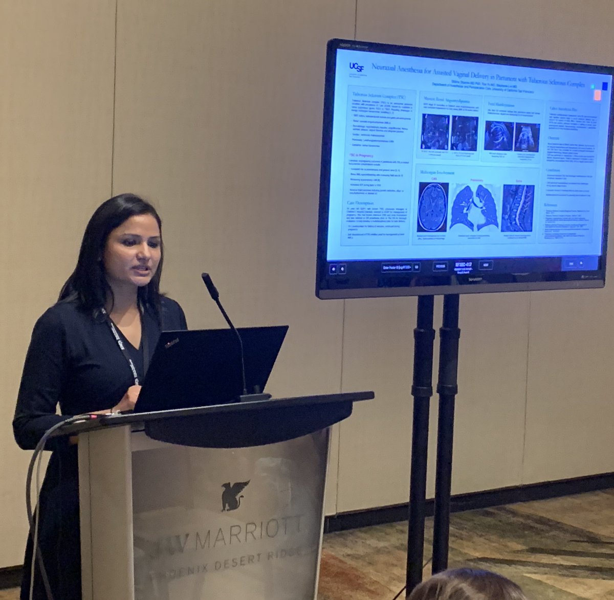 UCSFAnesthesia's tweet image. Dr. Tina Yu &amp;amp; Dr. Shikha Sharma representing at #SOAPAM2019 this past weekend.  #OBAnes