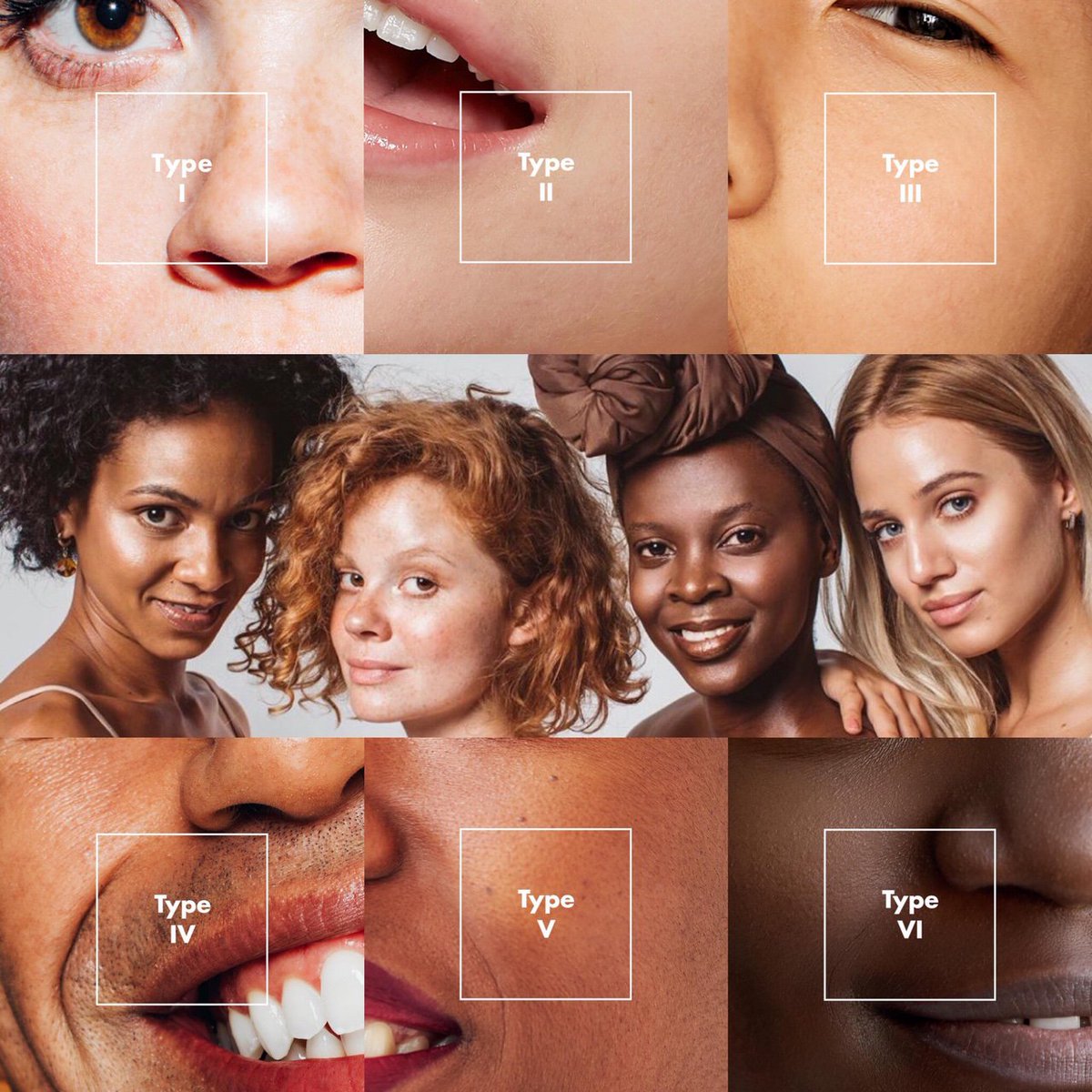ObagiUK's tweet photo. Who’s heard of the Fitzpatrick skin spectrum?
This scale categorizes skin into six different types based on its response to ultraviolet light (the sun).
#nowyouknow #knowyourskin #skintype #obagiuk https://t.co/9U8NicFbzv