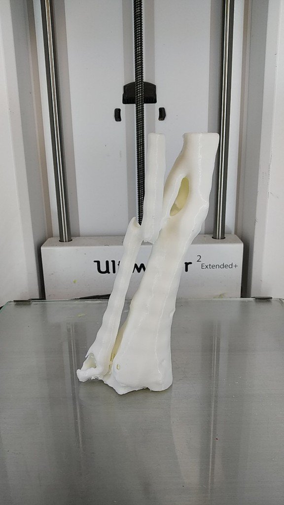 3d_maranon's tweet photo. 3D Model of a fracture of tibia and fibula. This case will increase the repository of medical cases in the Hospital Gregorio Marañón #HospitalMarañon3D The FabLab team carried out this proyect @rupermac @calvoharo_ja @diegotrap @kn_ord @sandrasv97 https://t.co/rkQZbWr0ln