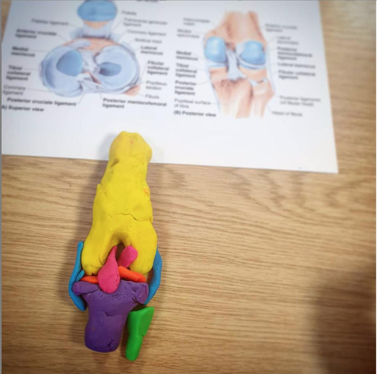 Play-doh joints of the upper & lower limbs using different colours to create bones, articular surfaces and ligaments
#artbeatedinburgh #artandanatomy #playdoh #modelling #humananatomy