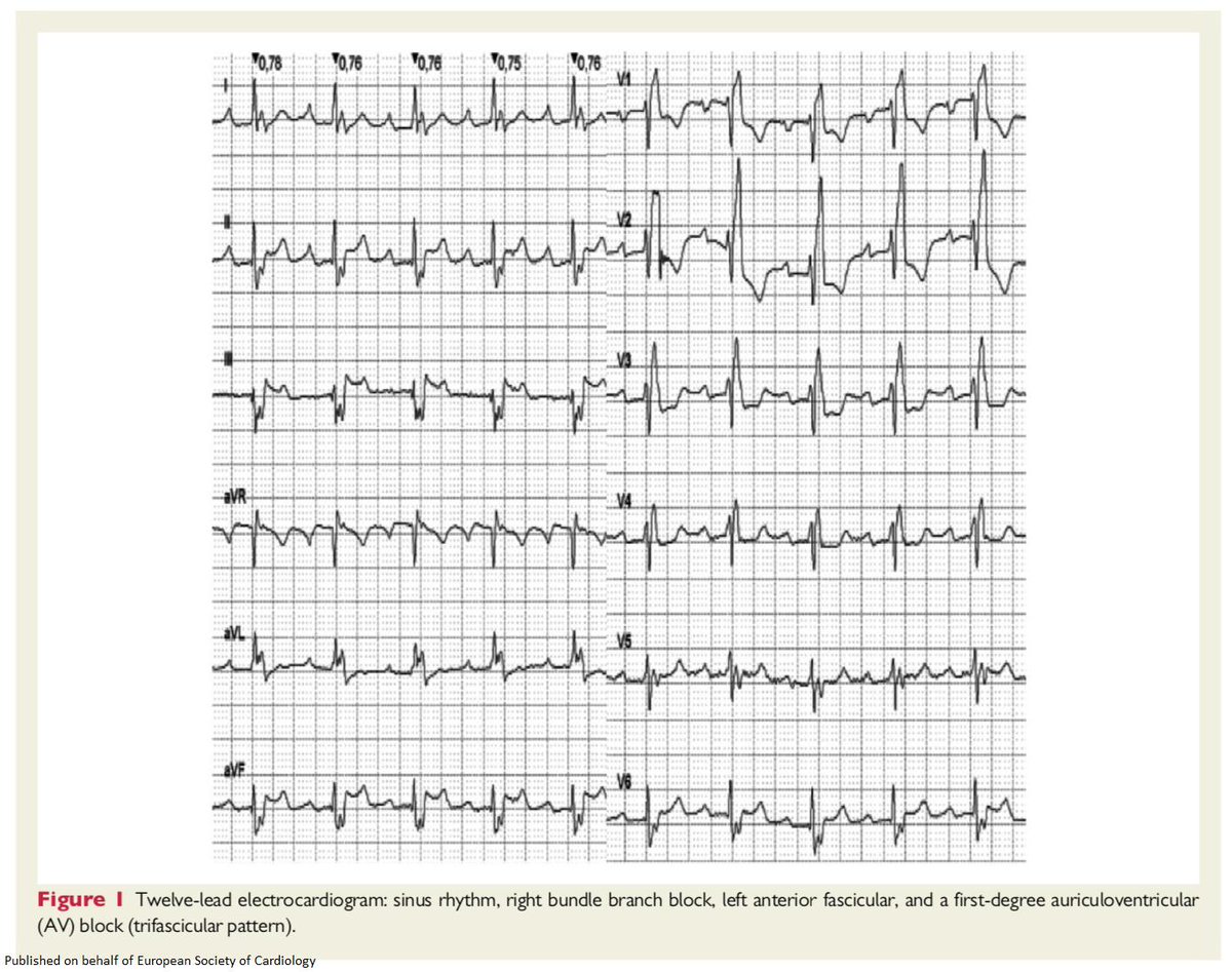 European Society of Cardiology Journals tweet media