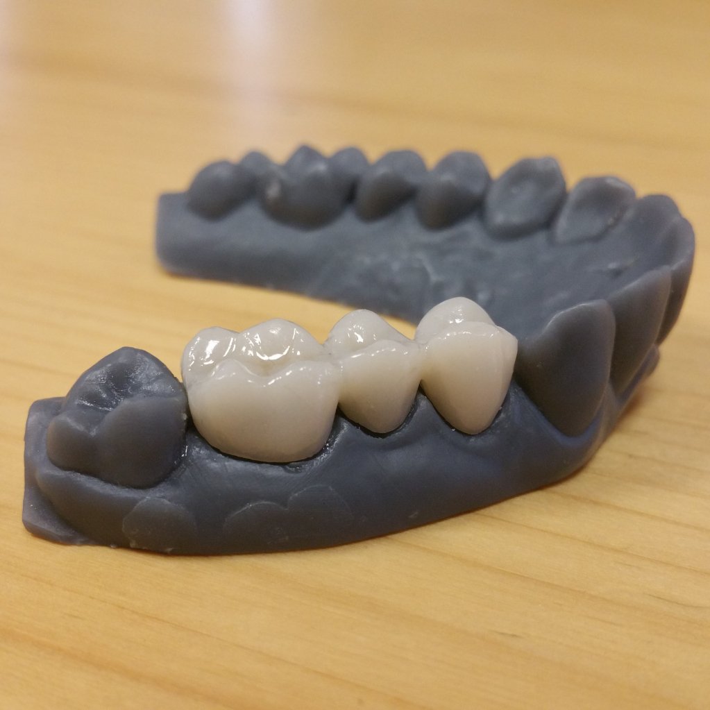 bilcotechsrls's tweet photo. Modello stampato con stampante Asiga Max e resina Standard Grey di Formlabs; ponte di tre elementi stampanto con resina Gr-17 Pro3dure, colorazione A2.
#bilcotech #bilcotech3d #stampa3d #modello3d #formlabs https://t.co/Pg9jP2W1oK