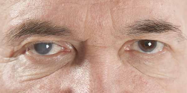 SafarianSimon's tweet photo. The sun's #UV rays can cause serious damage to your vision, increasing your risk of #cataracts, #maculardegeneration and #photokeratitis. Get clued up on the effects this Sun Awareness Week. https://t.co/4lpU7lVvFN #sunawarenessweek #optician #stjohnswood #london https://t.co/xtFj6FaWdT