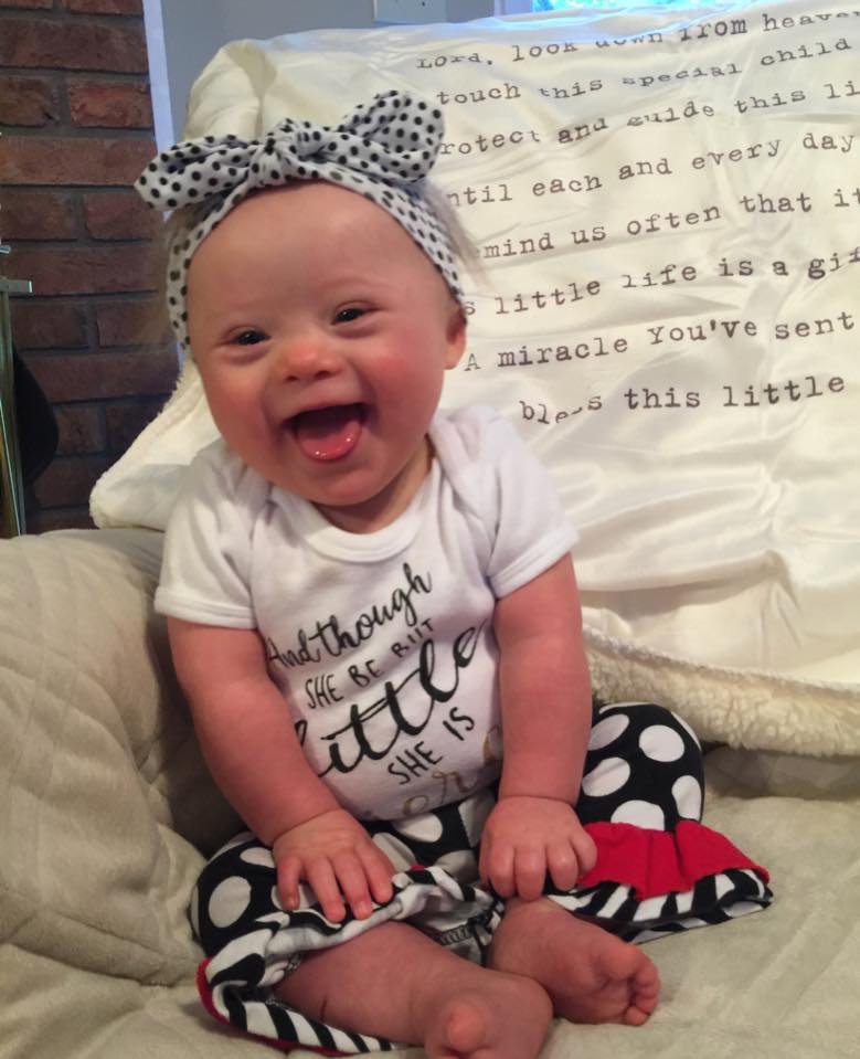 RightToLifeUK's tweet photo. Such a cutie 😍
.
.
.
#downsyndrome #dontscreenusout #prolife #abortion #disability #downpride https://t.co/wfWnXFXgXE