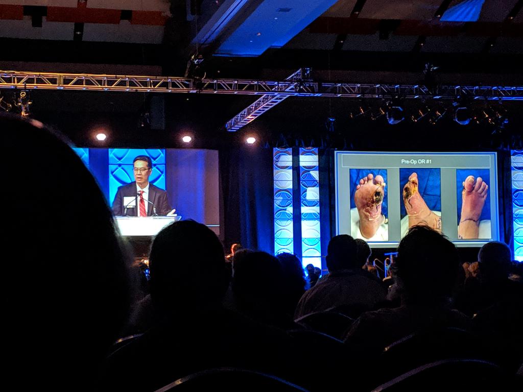 First up on <a href="/WoundHealingWHF/">WHF</a> #woundheal19 Day 2 is a series of talks regarding the continuum of clinical care for diabetic foot ulcers