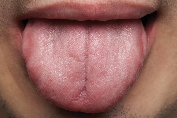 DentistryIQ's tweet photo. In her unofficial study, this #dental hygienist learned that no one was informed about regular care for their tongue. Yet it's a very important part of oral health care. Shouldn’t there be more conversations about caring for the tongue? #dentistry https://t.co/rbCFAmuK8U https://t.co/YYpxFAACnU