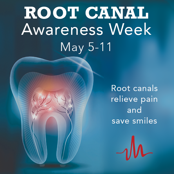 ImplantPractice's tweet photo. Don’t ignore #toothpain. Pain can mean tooth decay & infected root canals. Receiving a #RootCanal can save your tooth & stop the pain. 🦷
During #RootCanalAwarenessWeek, let’s shed light on the importance of seeing a dentist when experiencing pain. Your teeth are worth saving! https://t.co/QbBsrLpTqM