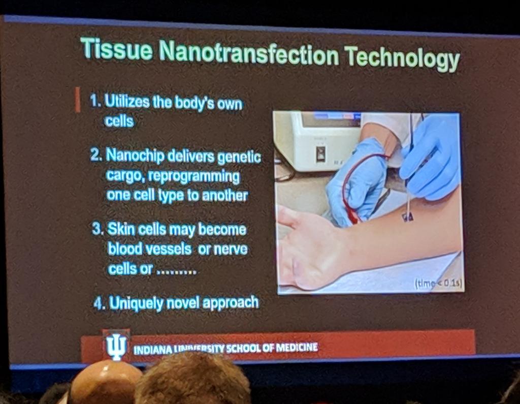 Reprogramming skin cells using nanochip electroporation in vivo to increase wound vascularisation. Brilliant talk by Dr Chandan K Sen at <a href="/WoundHealingWHF/">WHF</a> #woundheal19