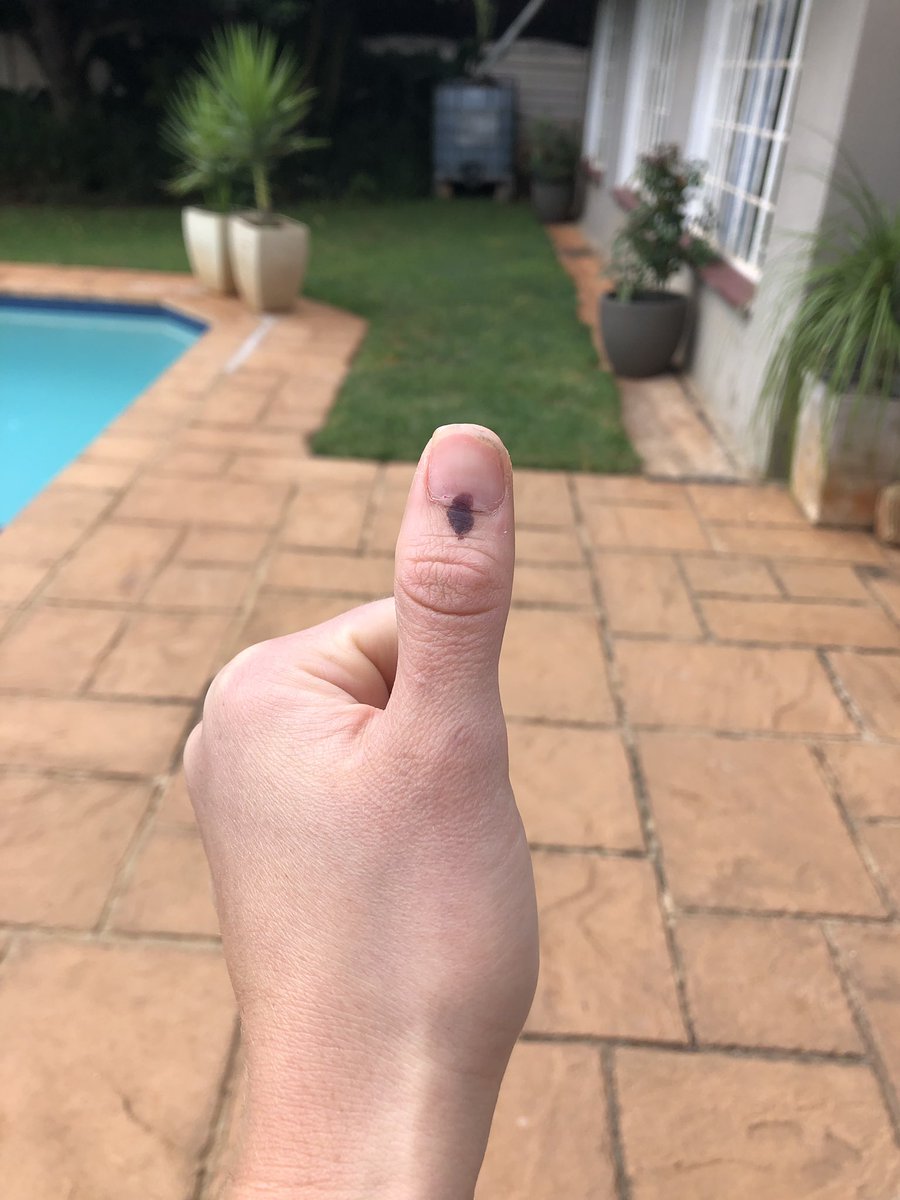 Had a photo shoot with my thumb today. Decided to chose this picture. Thumbs up 👍🏻