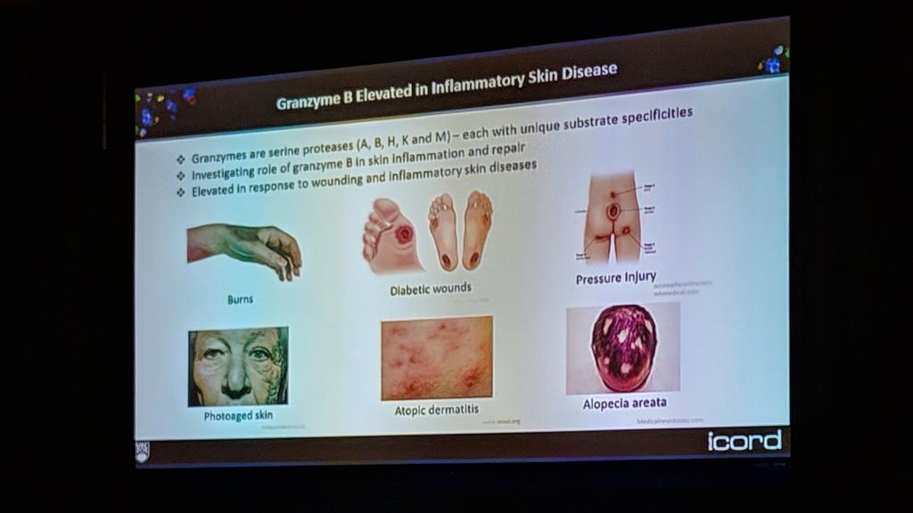 Great to hear from <a href="/_AWTRS/">AWTRS</a> 2018 Young Investigator Chris Turner speaking in the <a href="/WoundHealingWHF/">WHF</a> #woundheal19 Young Investigators session on Granzyme B and inflammation