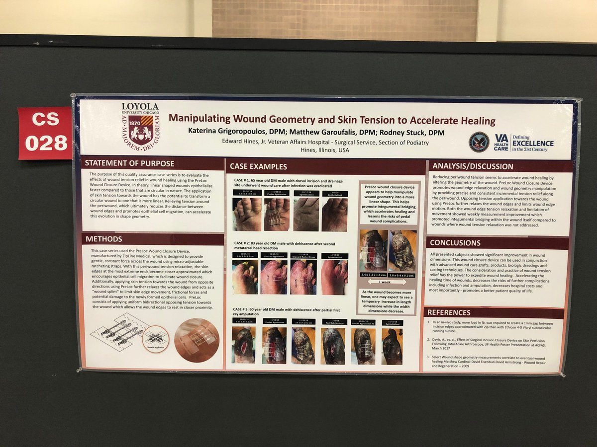 SAWC registrants, come by and check out ZipLine Medical’s positive clinical data highlighted in poster presentation CS028: Manipulating Wound Geometry and Skin Tension to Accelerate Healing #SAWCSPRING2019!  
Visit our booth#136 to learn about PreLoc &amp; Zip Surgical Skin Closure