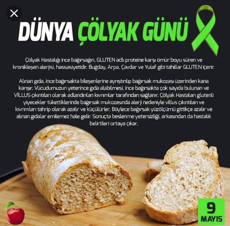 Kalin Bagirsak Uzunlugu Kalin Bagirsagin Bolumleri Bagirsak Org