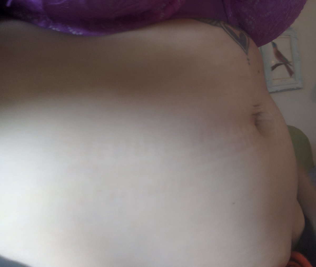 MindfullyMicha's tweet photo. I've had many messages from women upset about discussion on Meghans body.
In solidarity of real mum bodies before & after. Here's mine 4 years on. #bodynotcommodity They are not for you to sexualise, dehumanise or judge. They carry life #MeghanMarkle #BodyImage #feminism https://t.co/geINYXoI8M