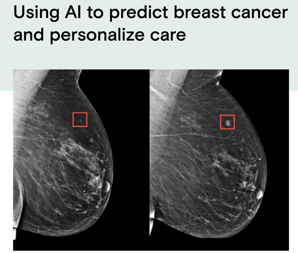 On our radar: A team from MIT’s Computer Science &amp; Artificial Intelligence Lab &amp; Massachusetts General Hospital has created a new deep learning model that can predict from a mammogram if a patient is likely to develop breast cancer in the future. More here bit.ly/2J81asm