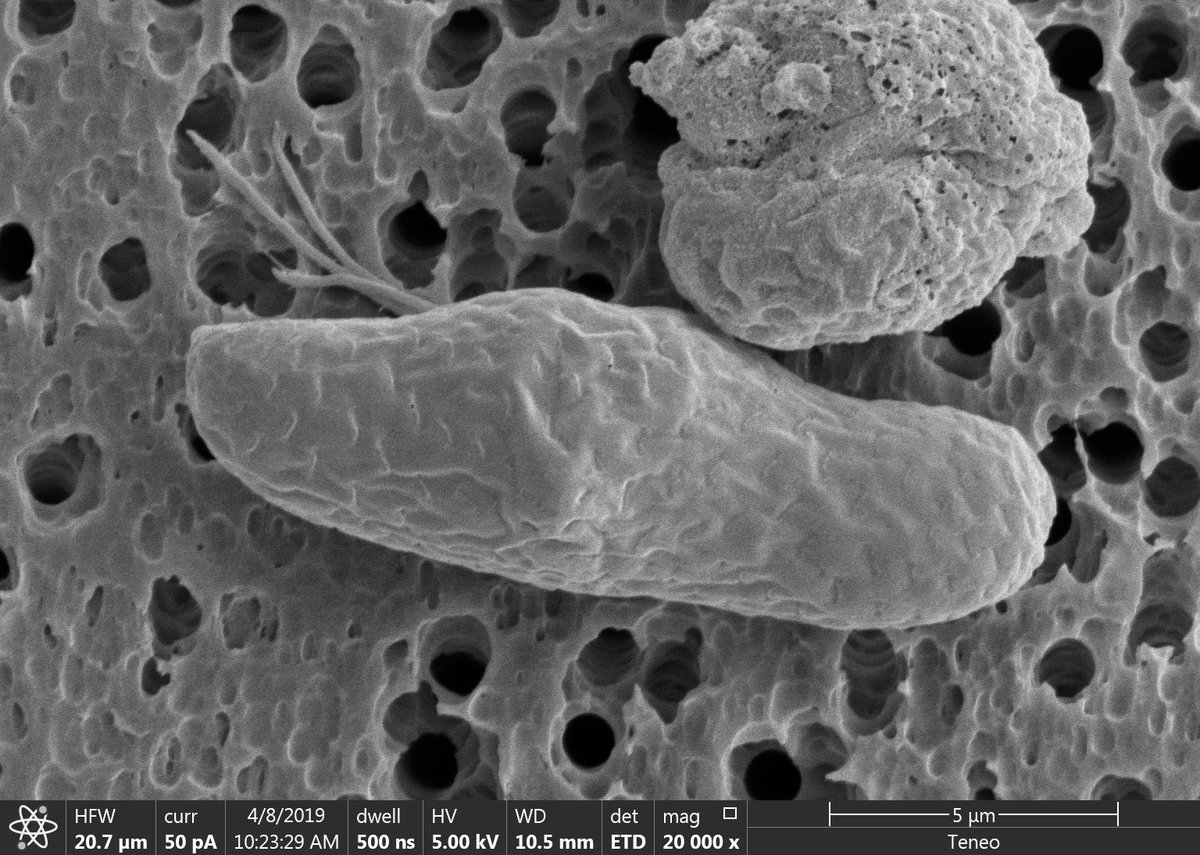 JLDudycha's tweet photo. FOR MATURE AUDIENCES ONLY. I think we caught Cryptomonas ovata in the act of reproducing. #Cryptophytes #SEM https://t.co/cJwgAjPS03