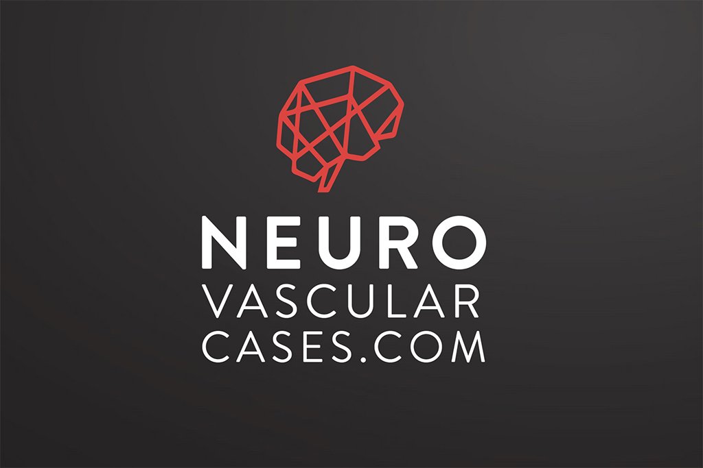 PittNeurosurg's tweet photo. Check out Ben Zussman’s https://t.co/xkHw2Hjfin website, a look at interesting cases and angiographic studies of normal and variant neurovascular anatomy, designed to help readers recognize and understand neurovascular disease. https://t.co/ZDunMbeDW6