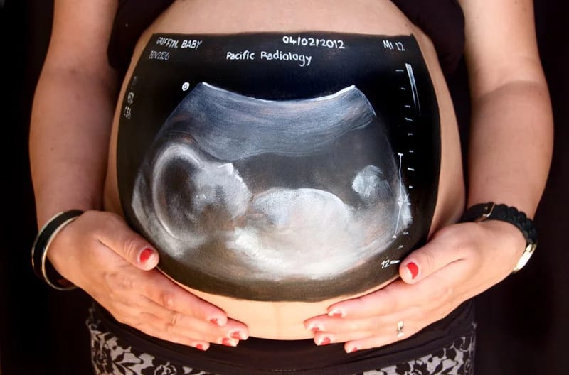 Daniela91660024's tweet photo. Mamá no pierdes tu vida diciendo Sí, por el contrario empiezas una nueva historia.. #PazEnElVientre https://t.co/Fdo4bXlUlN