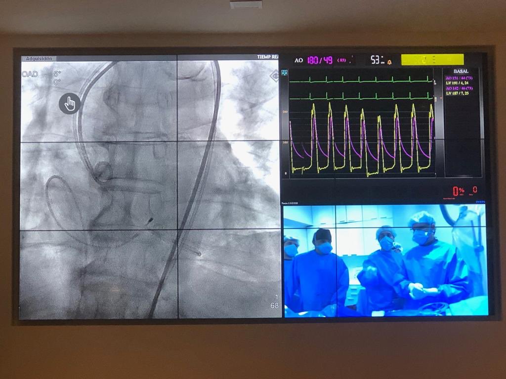 lamelaspablo's tweet photo. Fantastic #TAVR #Evolut meeting with the legend Dr Jean-Claude Laborde at @FundFavaloro #LatinAmericaFirst 🇦🇷. Live case and some tips-tricks (find some below in thread), “success is in the details”. https://t.co/7jWXJUd7pC