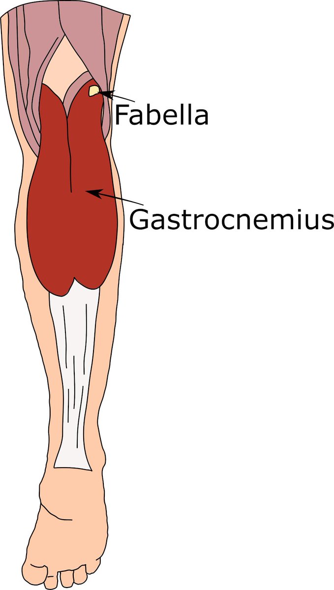 AnatomyToYou's tweet photo. In focus: The fabella, the forgotten knee bone (reposted to fix some errors-- but hey, you may have missed this before?) https://t.co/zPvEAJhFhM https://t.co/kijOXIgBTJ