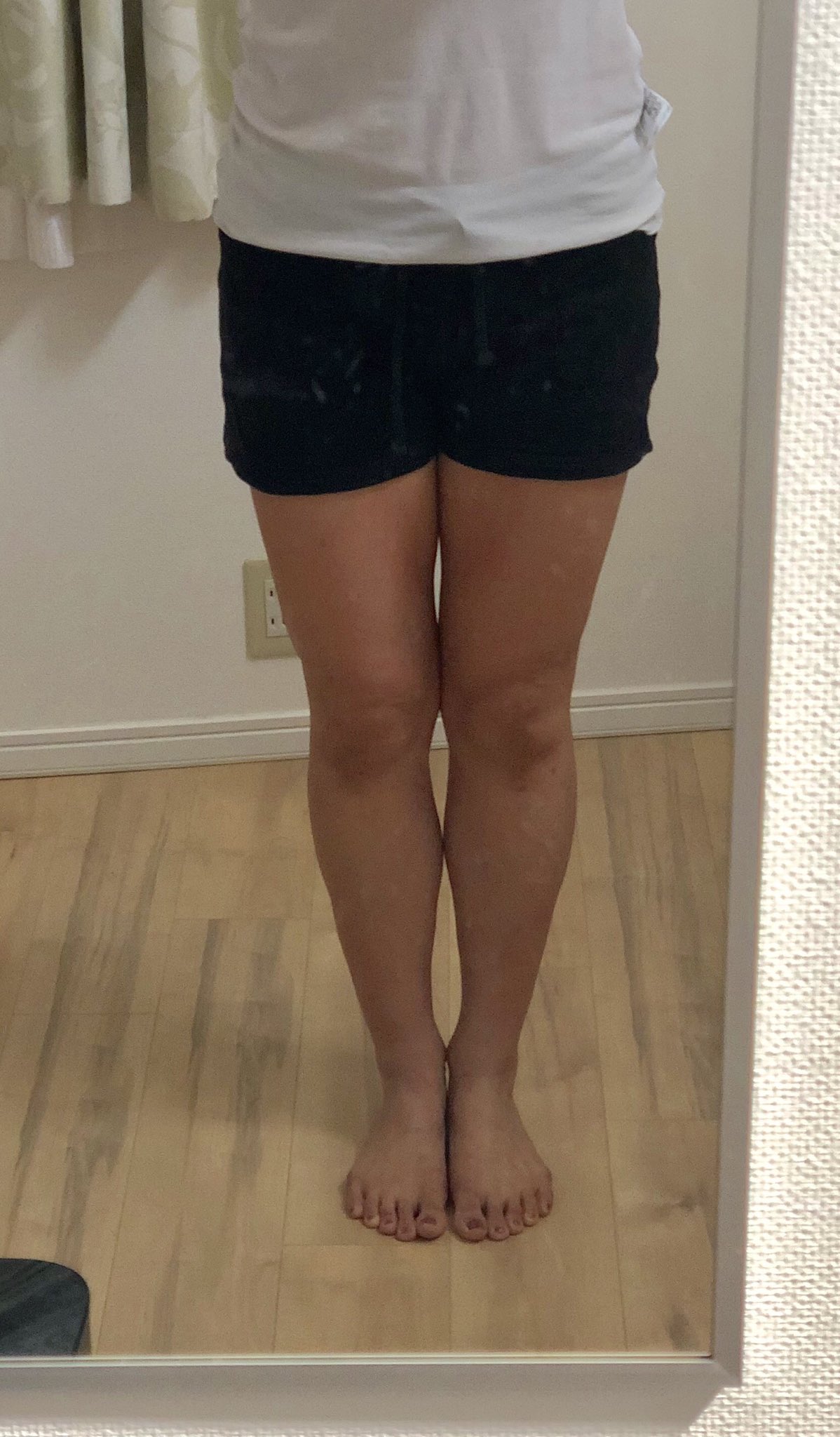 ショートパンツ履きたい 生足で履いても許せる足の太さとは Re Now