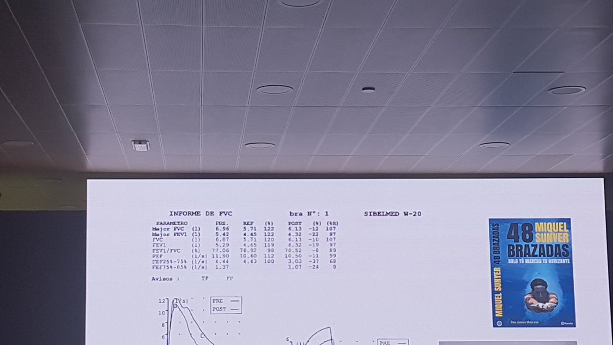 Asmayeducacion's tweet photo. El Dr.Drobnic nos habla de la Importancia de valorar la espirometria forzada con esfuerzo. un vamos basal de FEV1 o superior al esperado no descarta asma con el ejercicio . #SENP2019 @aepediatria @SENPneumoped @CongresoSENP @ASMA_SENP https://t.co/LUIFJXqdVR