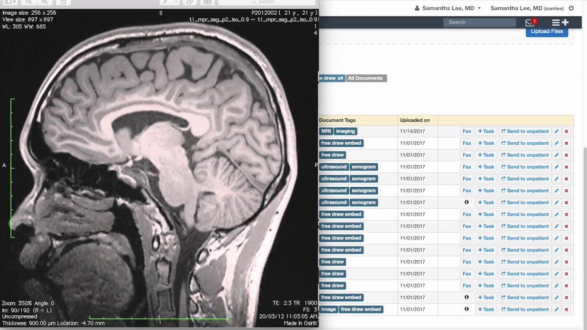 drchrono's tweet photo. How do you upload documents to your patient’s chart? Learn in this week’s #drchronotutorial video.
https://t.co/USJQgtUna0
#EHR #Training #ehrtraining #Charts #patientchart #Physician #healthcare #EHR101 #mhealth #digitalhealth #drchrono https://t.co/c0wV7DG2s0