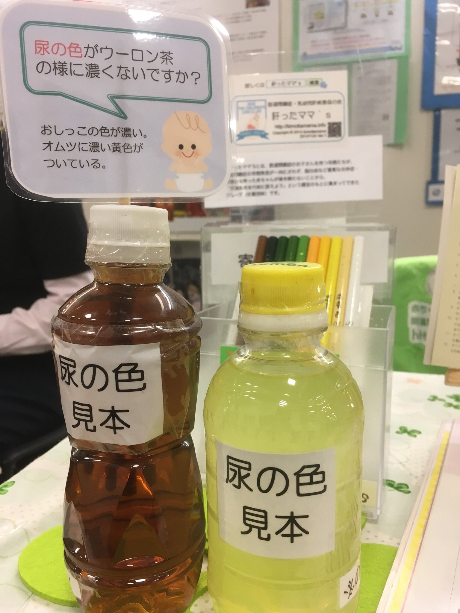 パパ小児科医 胆道閉鎖症の早期発見のために 母子手帳には便色カードがついていて一ヶ月健診の時に必ず確認しますが 尿の色が濃くなることも大事な情報です T Co Bxxayvtxuz パパ小児科医 胆道閉鎖症の早期発見のために 母子手帳には便色カードがついていて一ヶ月健診の時に必ず確認しますが 尿の色が濃くなることも大事な情報です T Co Bxxayvtxuz