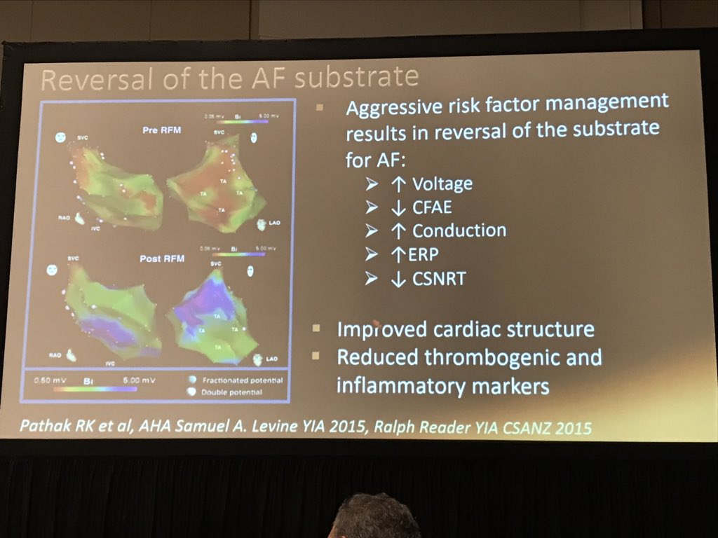 Christian Verdicchio (@c_verdicchio) on Twitter photo Assoc Prof <a href="/DH_Lau/">Dennis H Lau</a> showing how risk factor management reverses AF substrate and improved conduction pathways. <a href="/HRSonline/">Heart Rhythm Society</a> <a href="/PrashSanders/">Prash Sanders</a> #HRS2019 Assoc Prof <a href="/DH_Lau/">Dennis H Lau</a> showing how risk factor management reverses AF substrate and improved conduction pathways. <a href="/HRSonline/">Heart Rhythm Society</a> <a href="/PrashSanders/">Prash Sanders</a> #HRS2019