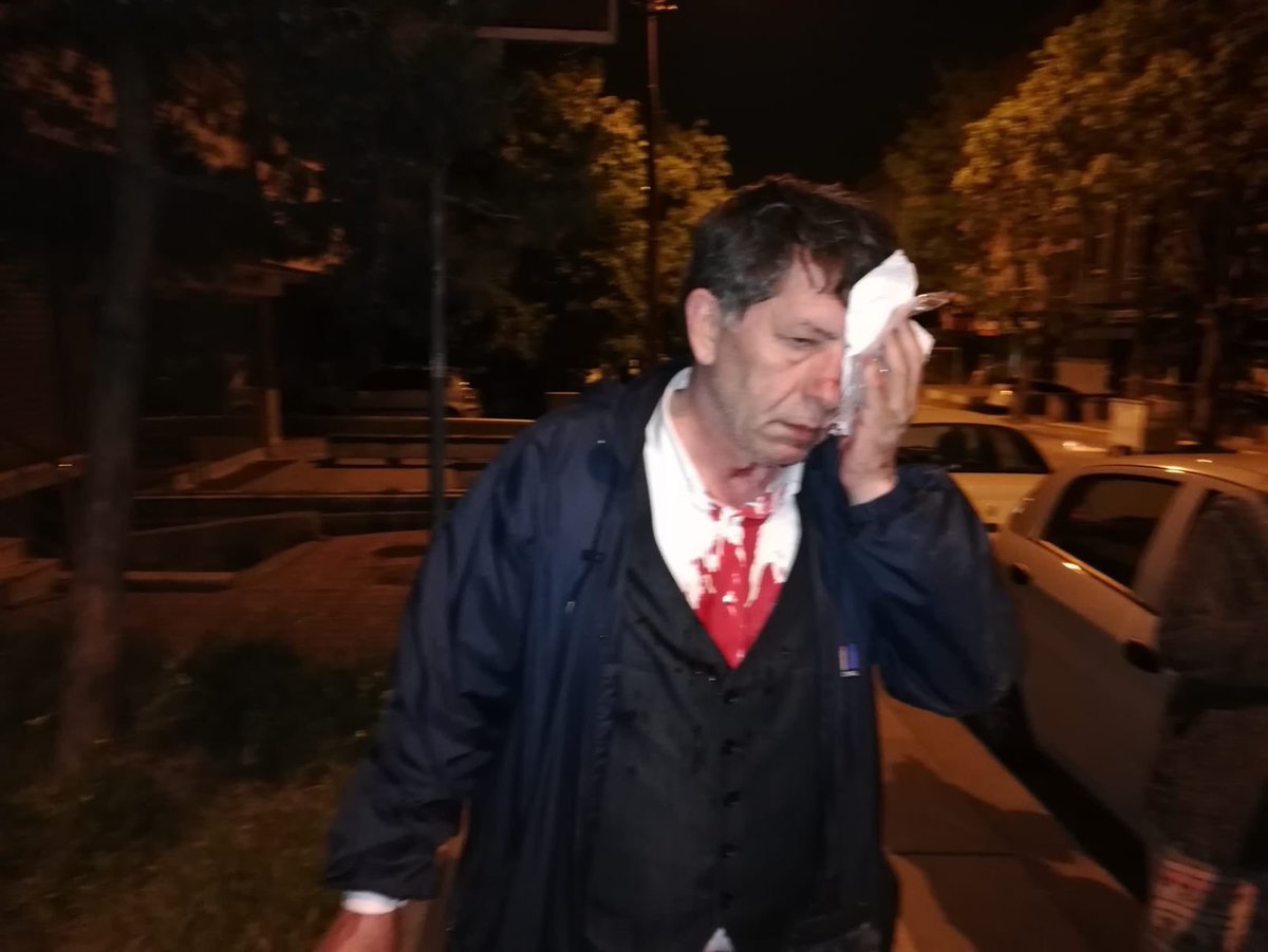 HaberDeger's tweet photo. Yeniçağ gazetesi yazarı Yavuz Selim Demirağ, kimliği henüz belirlenemeyen 7-8 kişinin beyzbol sopalı saldırısına uğradı. https://t.co/odnkoRvQQm