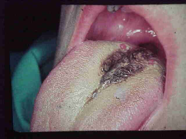 Drax 🔥 tweet media