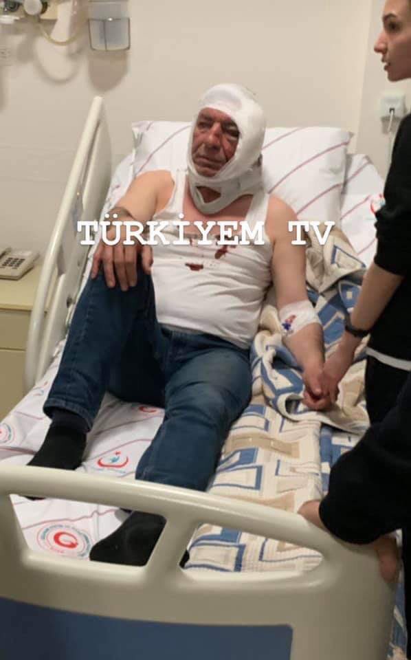 HaberDeger's tweet photo. Evinin önünde kimliği belirsiz kişilerin saldırısına uğrayan Yeniçağ yazarı Yavuz Selim Demirağ’ın hastane odasındaki görüntüsü ortaya çıktı. #YavuzSelimDemirağ https://t.co/vGMD346tt4