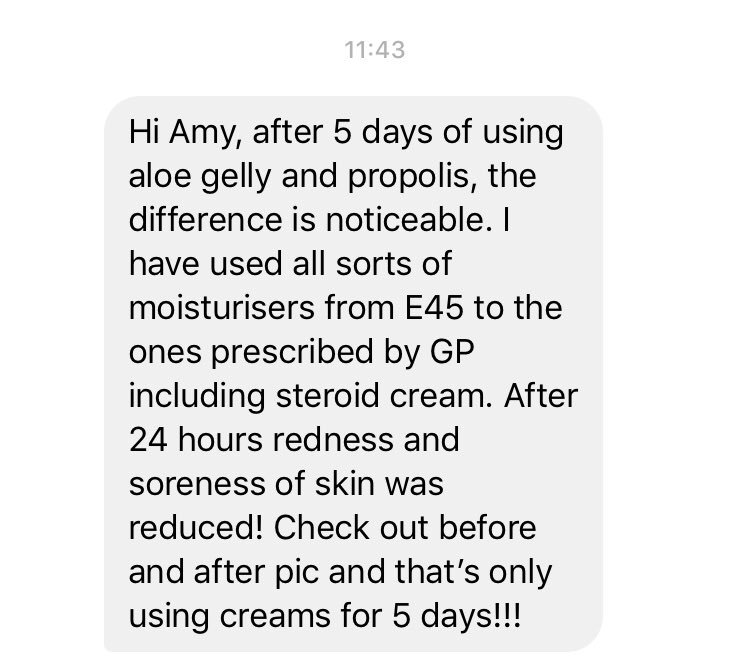 BengoughAmy's tweet photo. Ohhhh my days!!😱....Just look at the difference on this lady😧😨...it’s just amazing!!❤️....Honestly, the power of our products💜....#AloeVera #Natural #Healing💜💜 https://t.co/xlFmsyFbW3