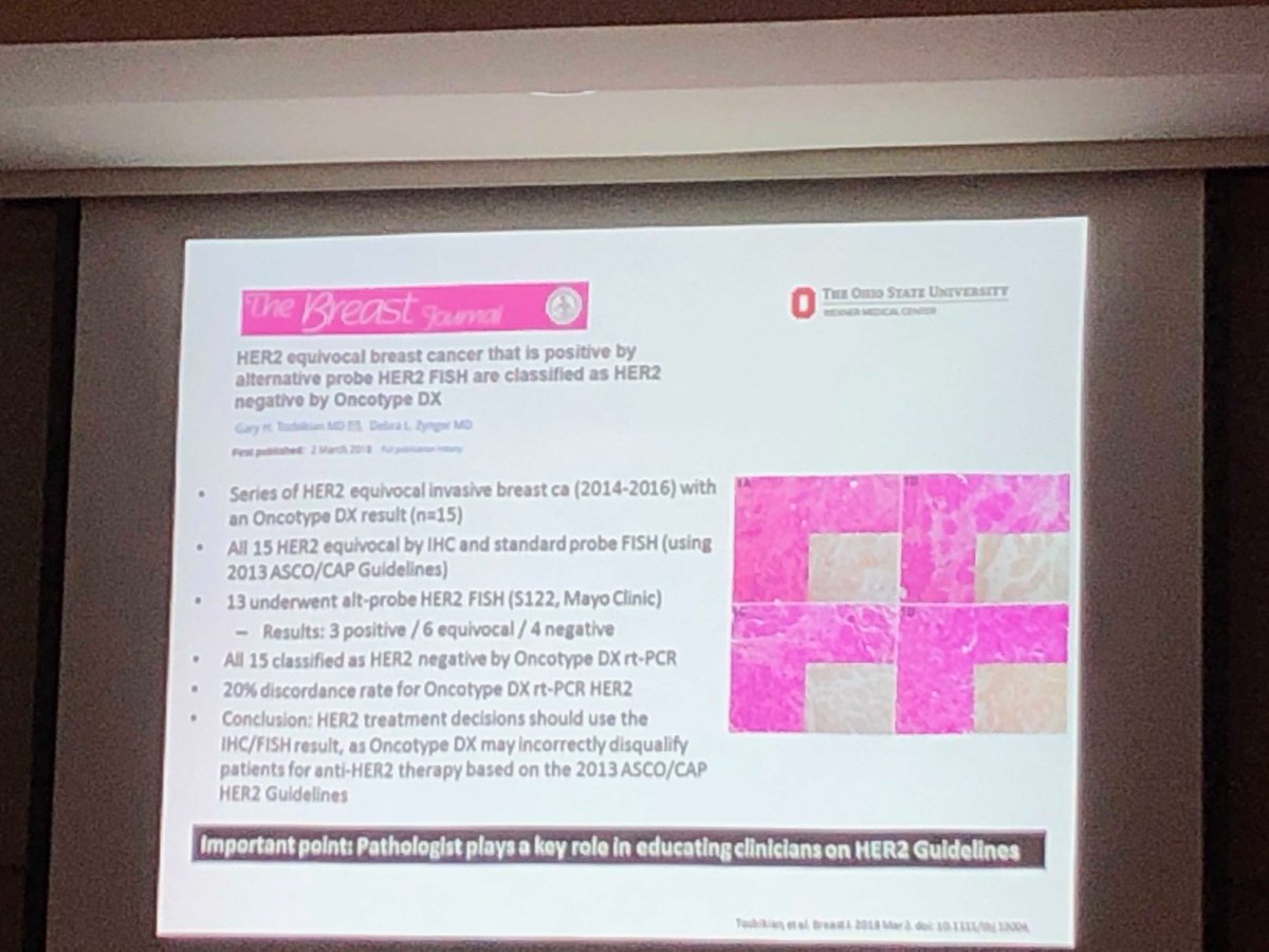 Use of OncotypeDX for Her2 testing may exclude incorrectly patients eligible for Herceptin— instead use CAP/ASCO guidelines with IHC/FISH —Dr. Gary Tozbikian ⁦@OSUPathRes⁩ #her2 #breastcancer