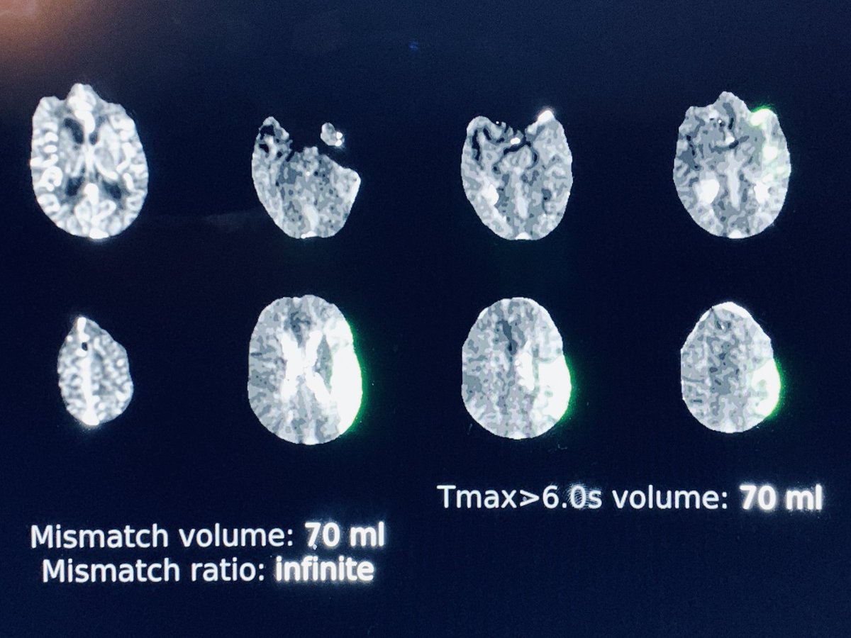 Newo.Icu/Ml Unlimited Diamonds