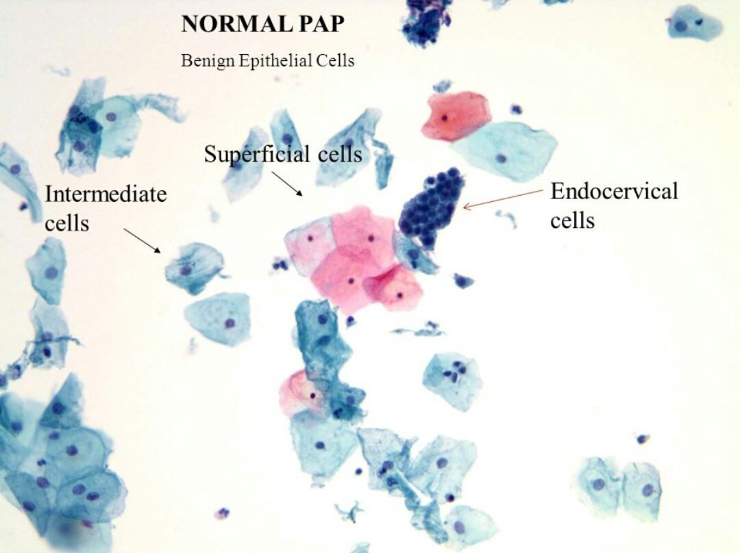 Intermediate Cells intermediate-cells