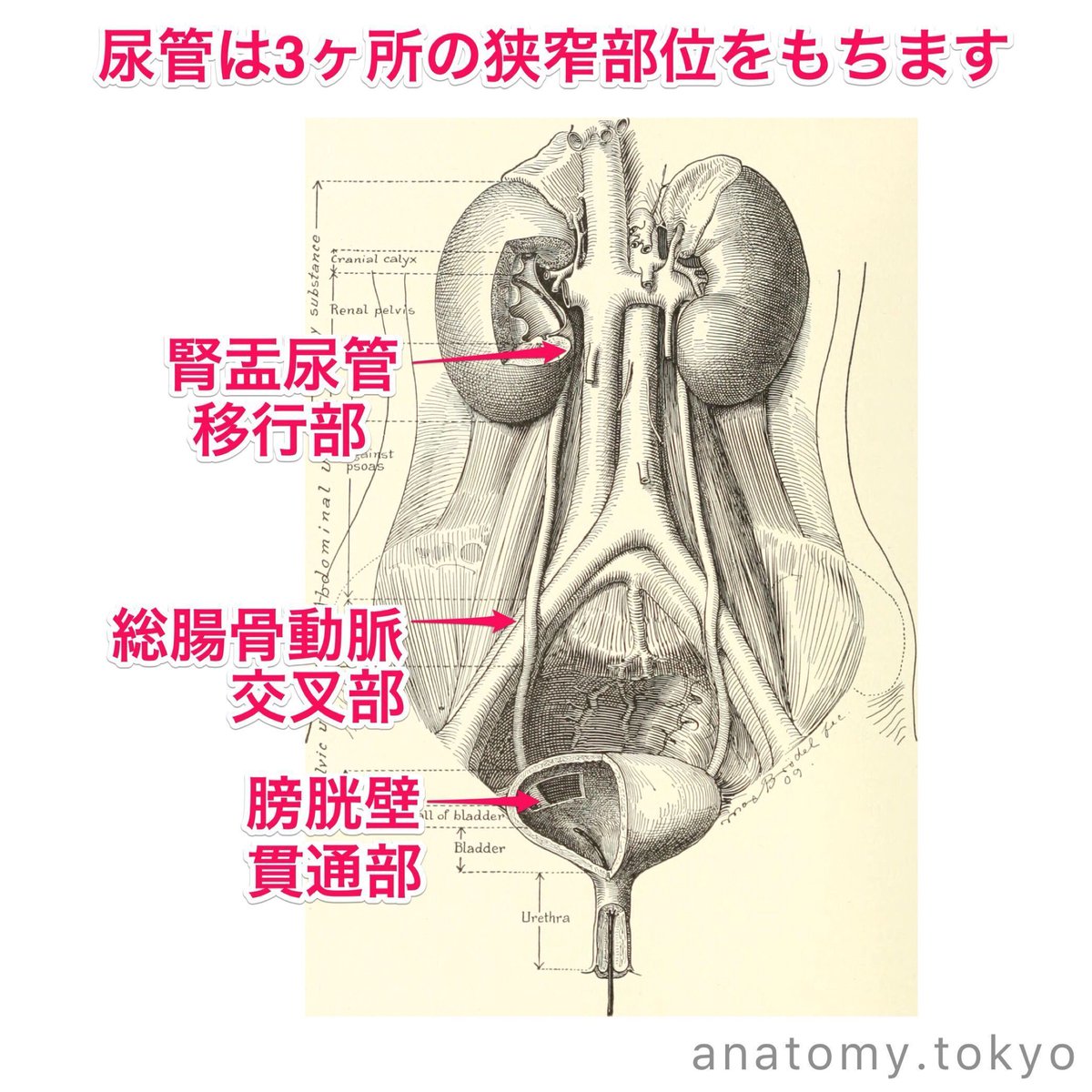 goukakuouenman's tweet photo. 尿管は (　　ヶ所) の狭窄部位をもつ

(解答) 3ヶ所
尿管は3ヶ所の狭窄部位をもちます。

#解剖学 #泌尿器系 #尿路 #urinary_duct #constrictions

【一問一答】
https://t.co/EsokEnaGsf https://t.co/68N2sU3Mvj