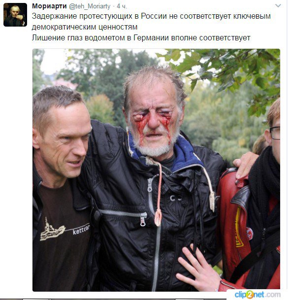 Актер которому выбили глаз. Повязка на глаз. Актер которому выбили глаз. Актер которому выбили глаз. Актер которому выбили глаз травматическим оружием.