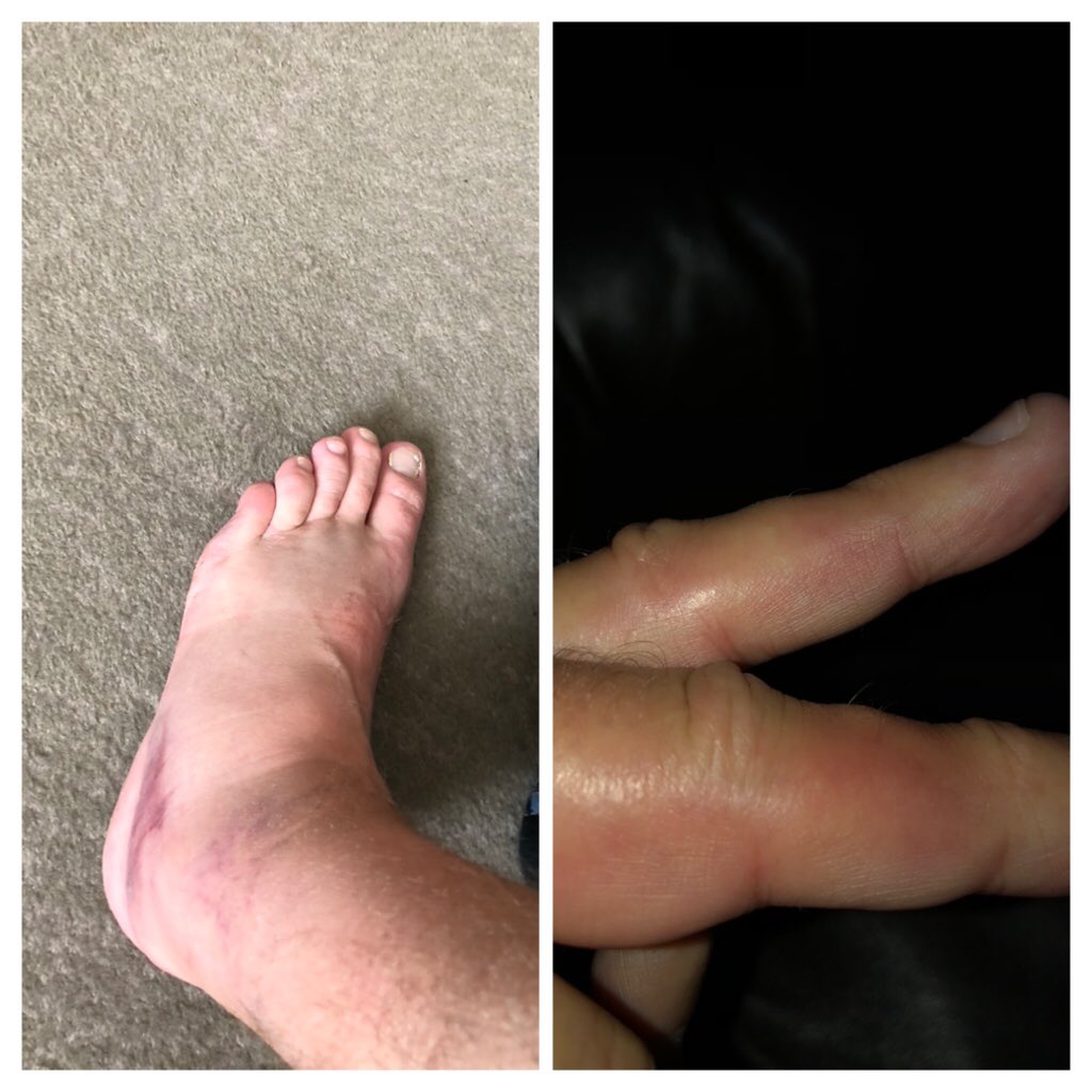 Chris Gates tweet media