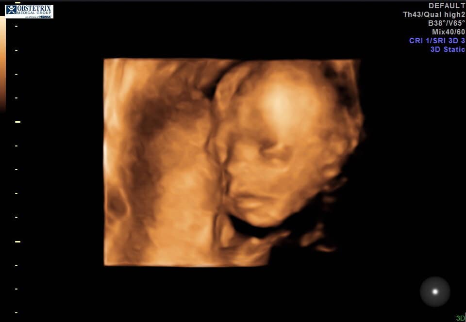 FJBTHbook's tweet photo. Brian and Holly Festa lost two children in 18 months! Dreams of a big family weakened. But God doesn’t let our hopes fade! I'm so pleased that God has blessed them richly! They'll welcome Taelynn Festa in September! Baby No. 5! #perseverance #family #HappyMothersDay #FJBTH https://t.co/zC7jcpK2ne