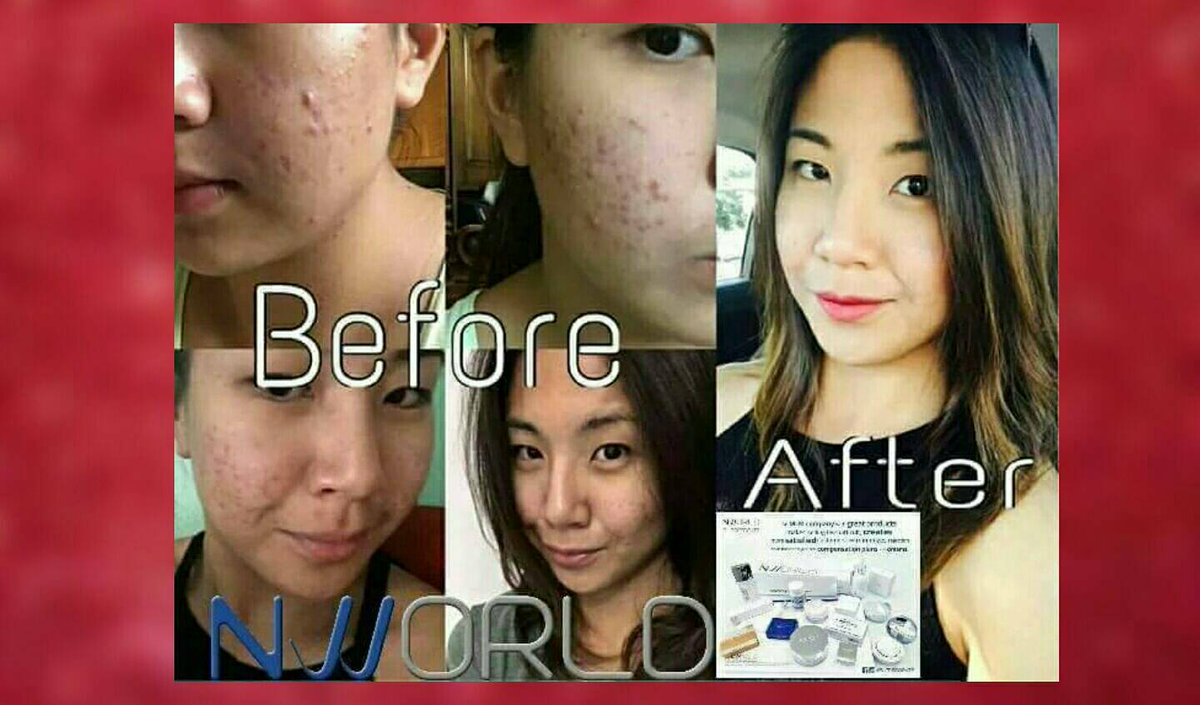 Jamie_nworld's tweet photo. Proven &amp; effective be #Nlighten ORDER now / be a RESELLER! +63-915-759-1516 Get it today! #Nworld #Koreanmade https://t.co/bMVGCY891F