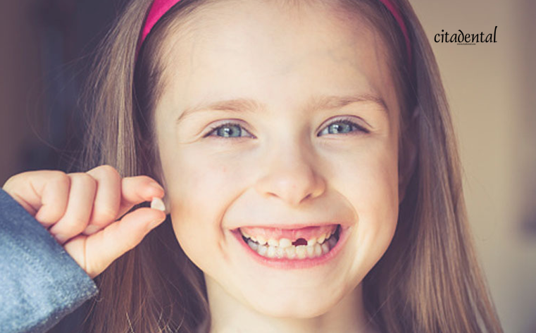 Citadental's tweet photo. ¿Le están saliendo los dientes de leche a tu hijo? te contamos qué debes saber y hacer. https://t.co/sQOcRlbY99 #citadental #felizlunes https://t.co/yqCfQb8Dmh