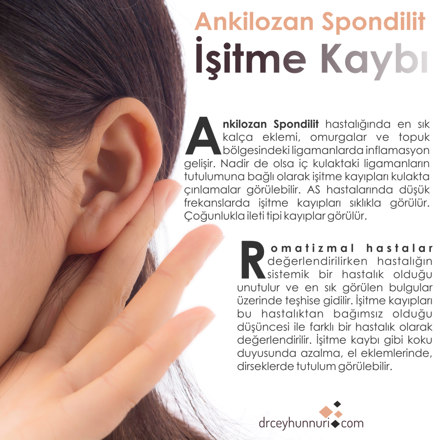 drceyhunnuri's tweet photo. Romatizmal hastalar değerlendirilirken hastalığın sistemik bir hastalık olduğu unutulur ve en sık görülen bulgular üzerinde teşhise gidilir. İşitme kayıpları bu hastalıktan bağımsız olduğu düşüncesi ile farklı bir hastalık olarak değerIendirilir. 
https://t.co/07wnHvp0Vf https://t.co/MOMH8jzcre