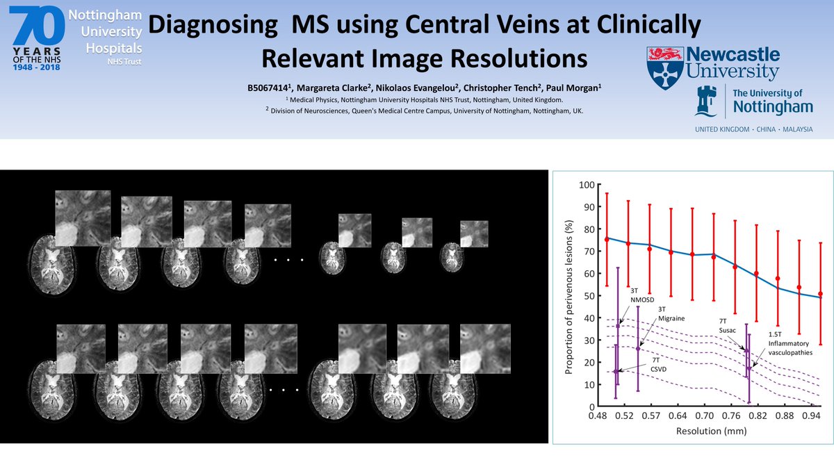 Come and see me at poster 170 at 16:45 tomorrow to find out about diagnosing MS using central veins. #ISMRM19 #MultipleSclerosis #MRI
