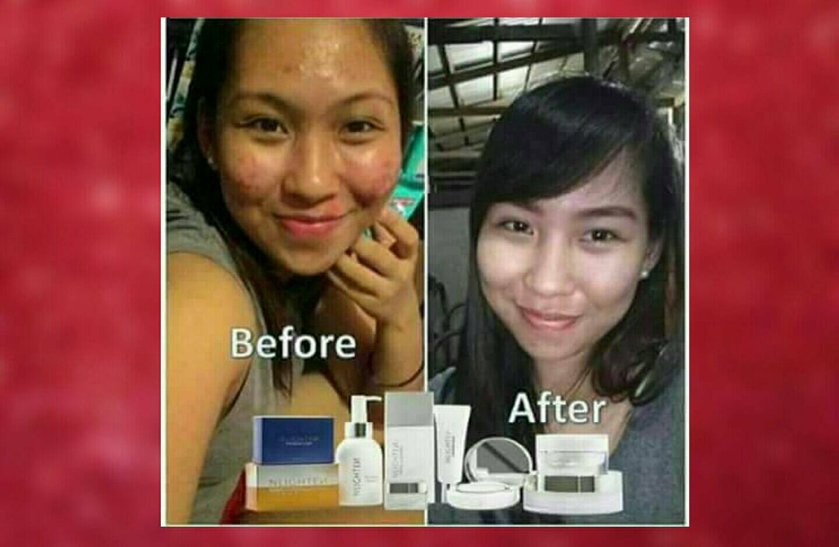 Jamie_nworld's tweet photo. Korean-like and young skin? ORDER now/be a RESELLER (Get 35% OFF)! +63-915-759-1516 #Nworld #Alpha #Beauty #Koreanmade https://t.co/FVeRfxpfbS